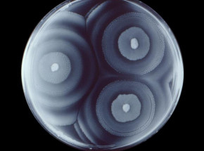 Opracowano nową metodę szyfrowania wiadomości opartą na wzorcach wzrostu bakterii