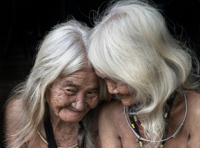 Europejskie włosy szybciej się starzeją