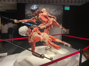 To trzeba zobaczyć na żywo - „Body Worlds” [RELACJA]