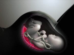 Chiny: w mózgu rocznej dziewczynki rozwinął się płód