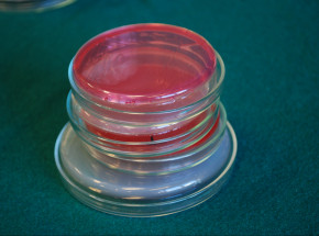 Po raz pierwszy zużycie antybiotyków w rolnictwie jest niższe niż w medycynie ludzkiej