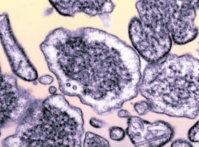 Indie: epidemia wirusa Nipah w stanie Kerala