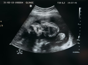 Izraelscy naukowcy stworzyli sztuczne łono. Czy rozmnażanie bez ciąży zmieni nasz świat?