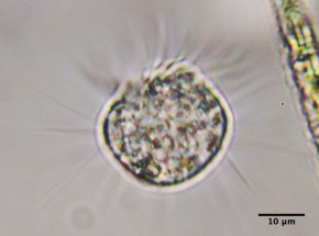 Odkryto, że orzęsek halteria odżywia się wirusami