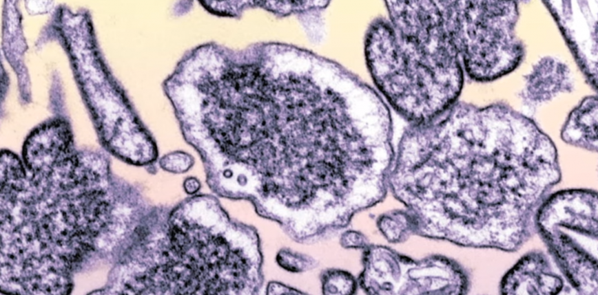 Indie: epidemia wirusa Nipah w stanie Kerala